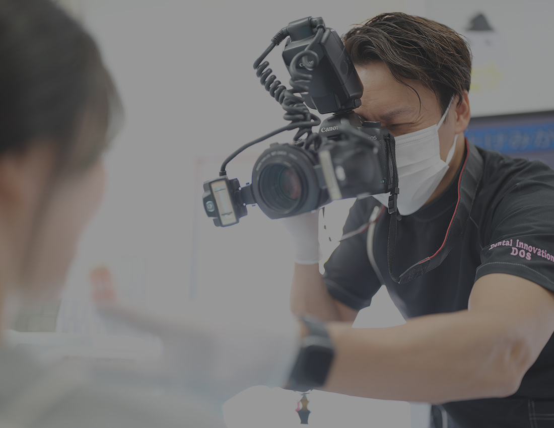 シェードテイキングで自然な美しさを実現