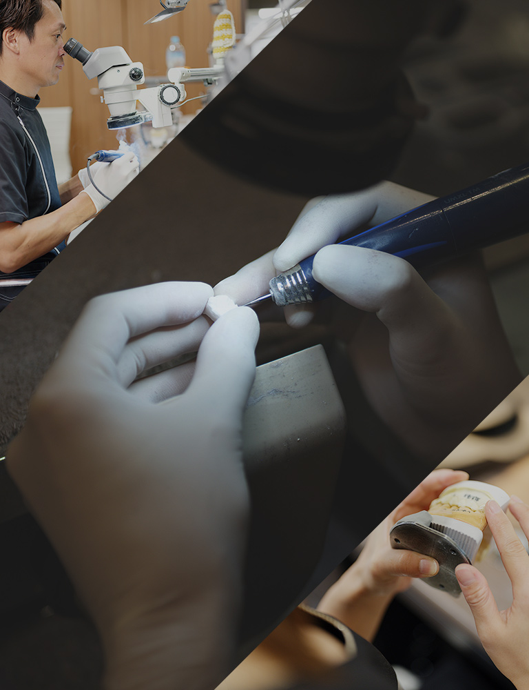 オーダーメイドのセラミック製人工歯