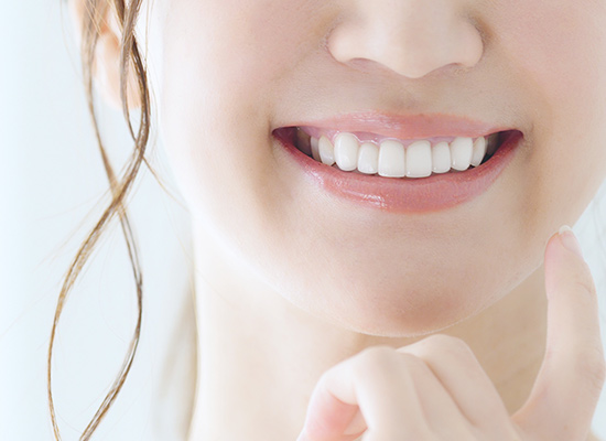 セラミック矯正